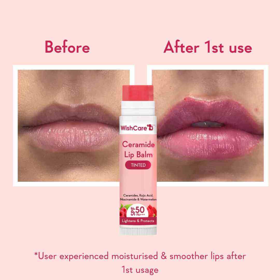 Wishcare Ceramide Lip Balm with SPF 50 PA+++ Tinted 5gm- P