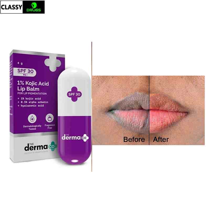 The Derma Co 1% Kojic Acid Lip Balm SPF 30 PA++ for Lip Pigmentatio