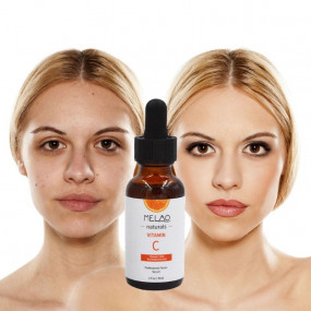 MELAO Acne Clarifying Vitamin C Serum