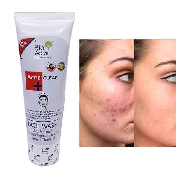 Bio Active Acne Clear Face Wash 70gm