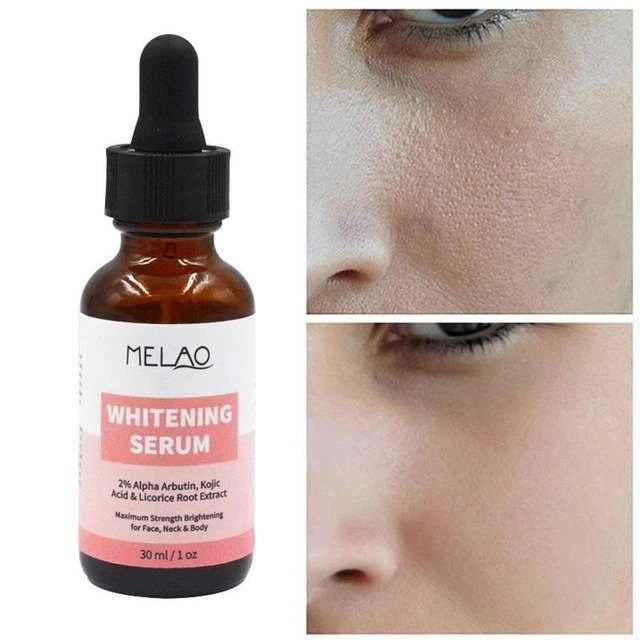 Melao 2% Alpha Arbutin kojic acid & Licorice root extract serum / whitening serum